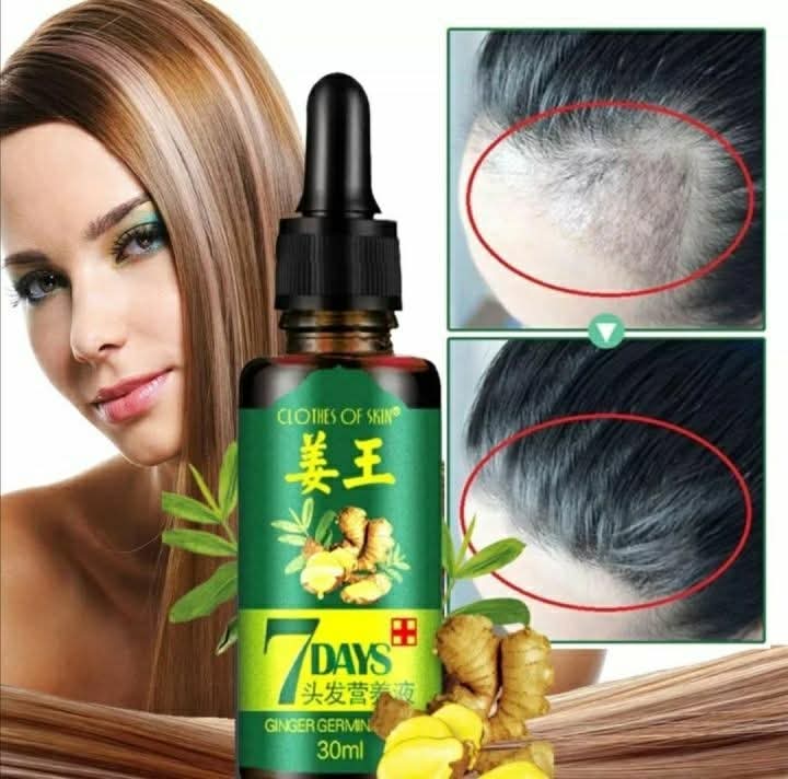 የፀጉር ማሳደግያ - Hairgrow